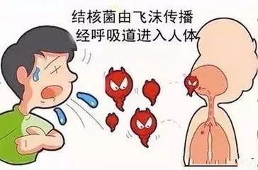 喷门迟缓症最新疗法