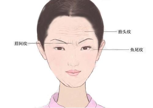 去除川字纹最好的安全的办法最新
